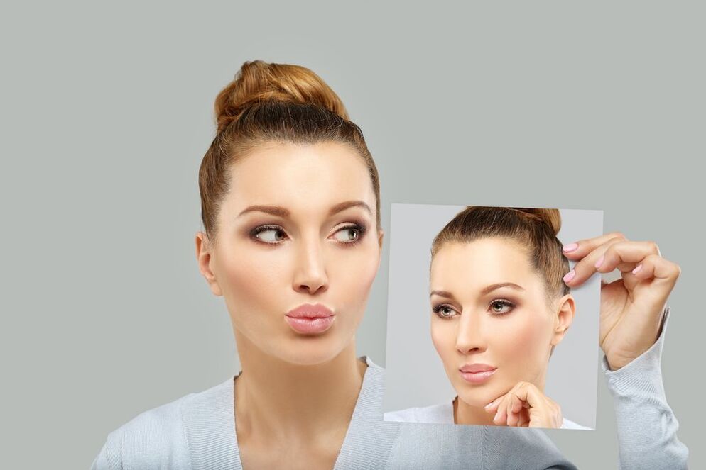 Женское лицо до и после ринопластики